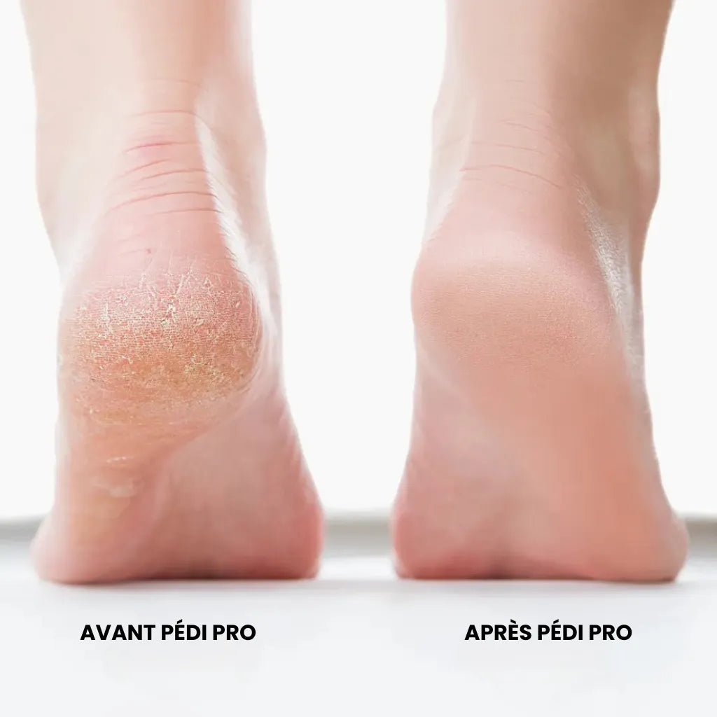 Pédi Pro 2 - Des pieds doux sans dépenser une fortune en salon