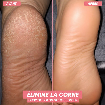 GlowFeet™ - L'original
